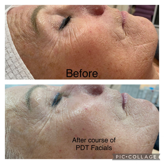 Sharon’s Skin Transformation Story