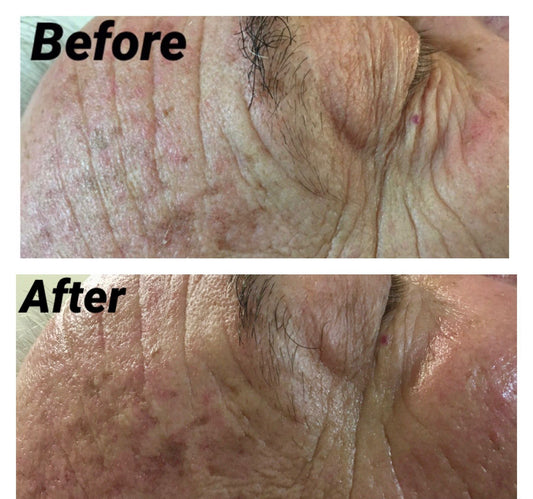 Skin Repair & Hydration - Danny (Age 64) - Real Results