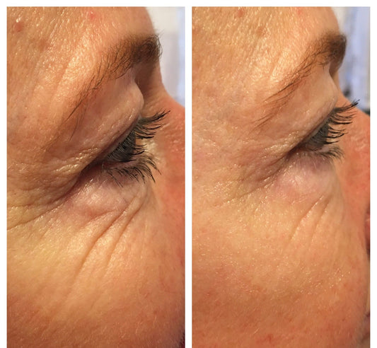 Bridal Skin Prep – Instant Eye Revival - Real Results