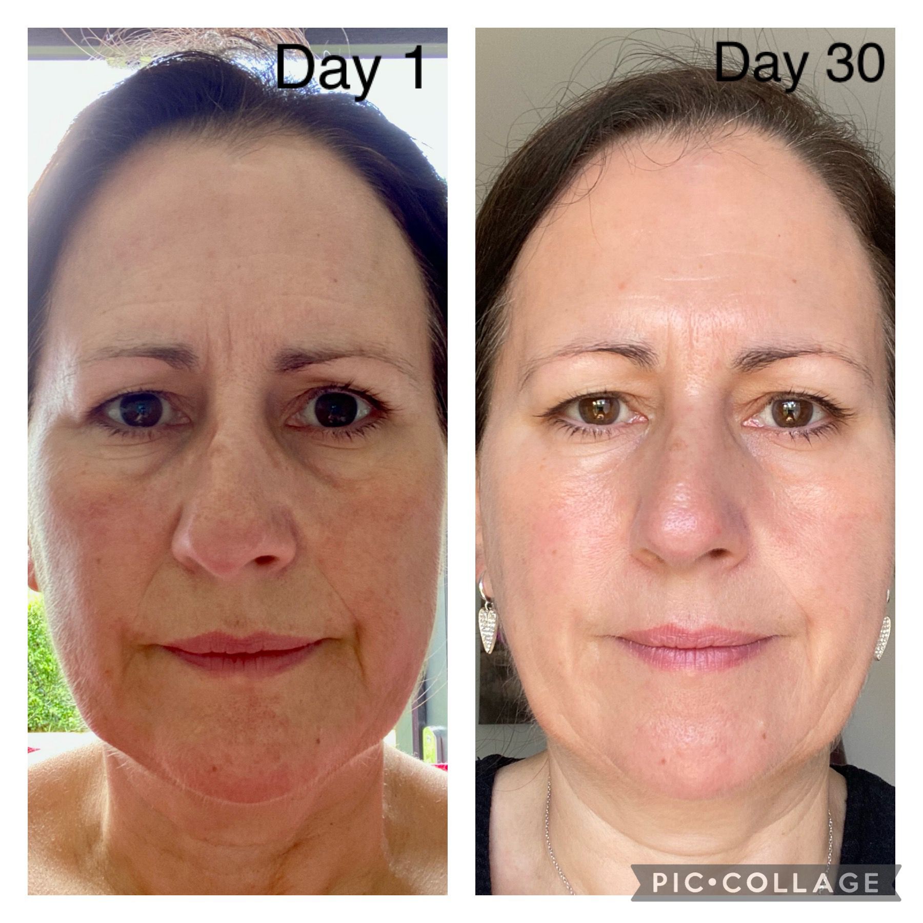 Katherine Daniels Skin Boost - Multi-Vitamin Concentrate – Visible Skin Renewal