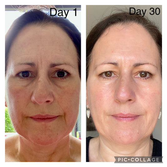 Katherine Daniels Skin Boost - Multi-Vitamin Concentrate – Visible Skin Renewal