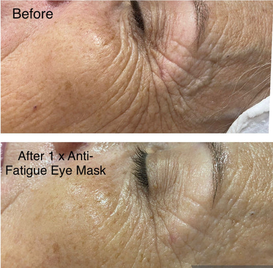 Busy Lifestyle Client – Express Skin Boost